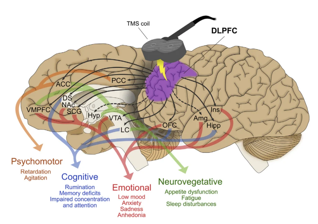 How TMS works on Brain Networks