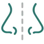 Septoplasty Illustration