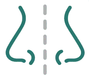 Septoplasty Illustration
