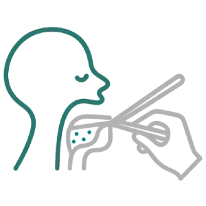 Tonsillectomy Procedure Illustration