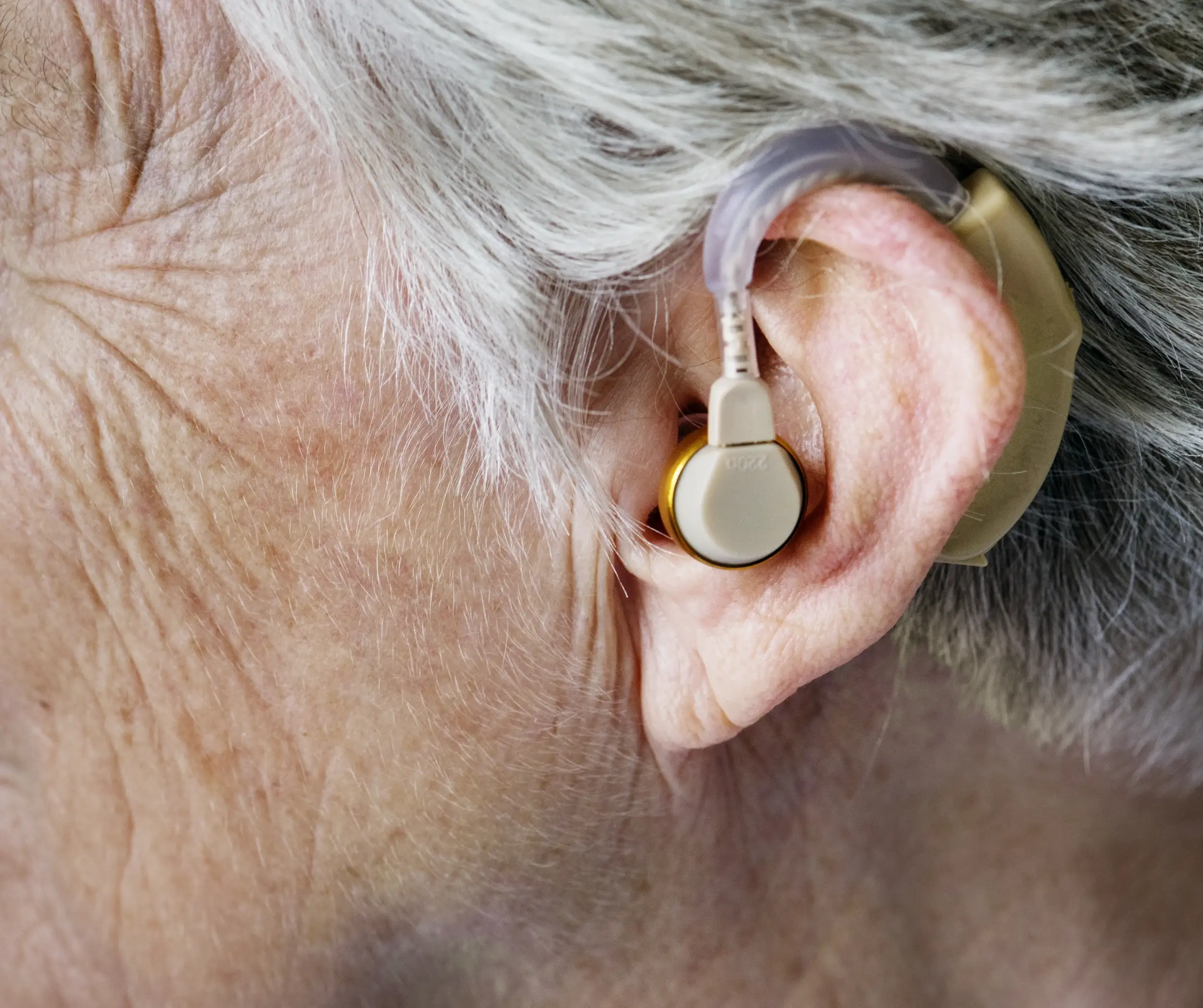 elderly-woman-wearing-hearing-aid