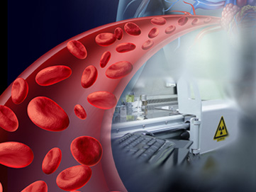 Radionuclide Angiography Muga Scan