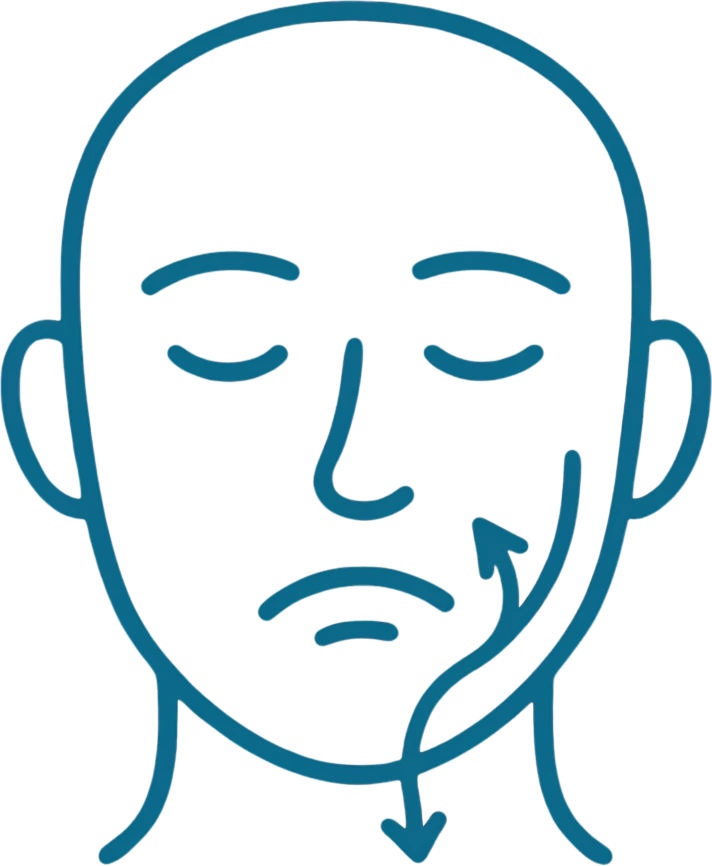 bells palsy