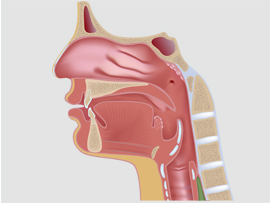 Dental Disease Goshen NY